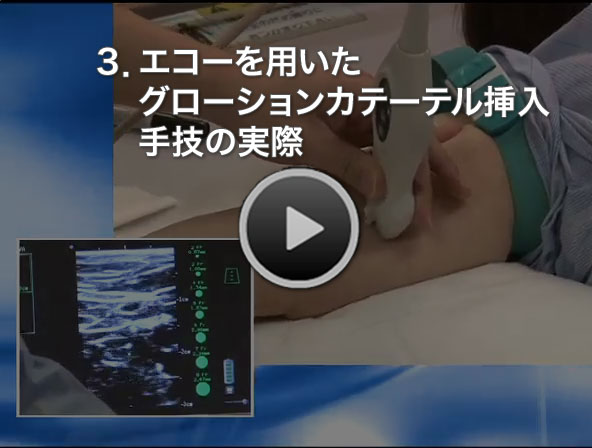 3.エコーを用いたグローションカテーテル挿入手技の実際-クリックで再生
