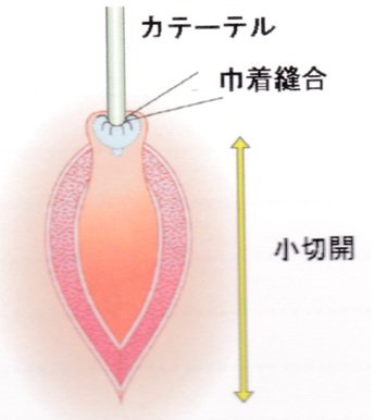 図2