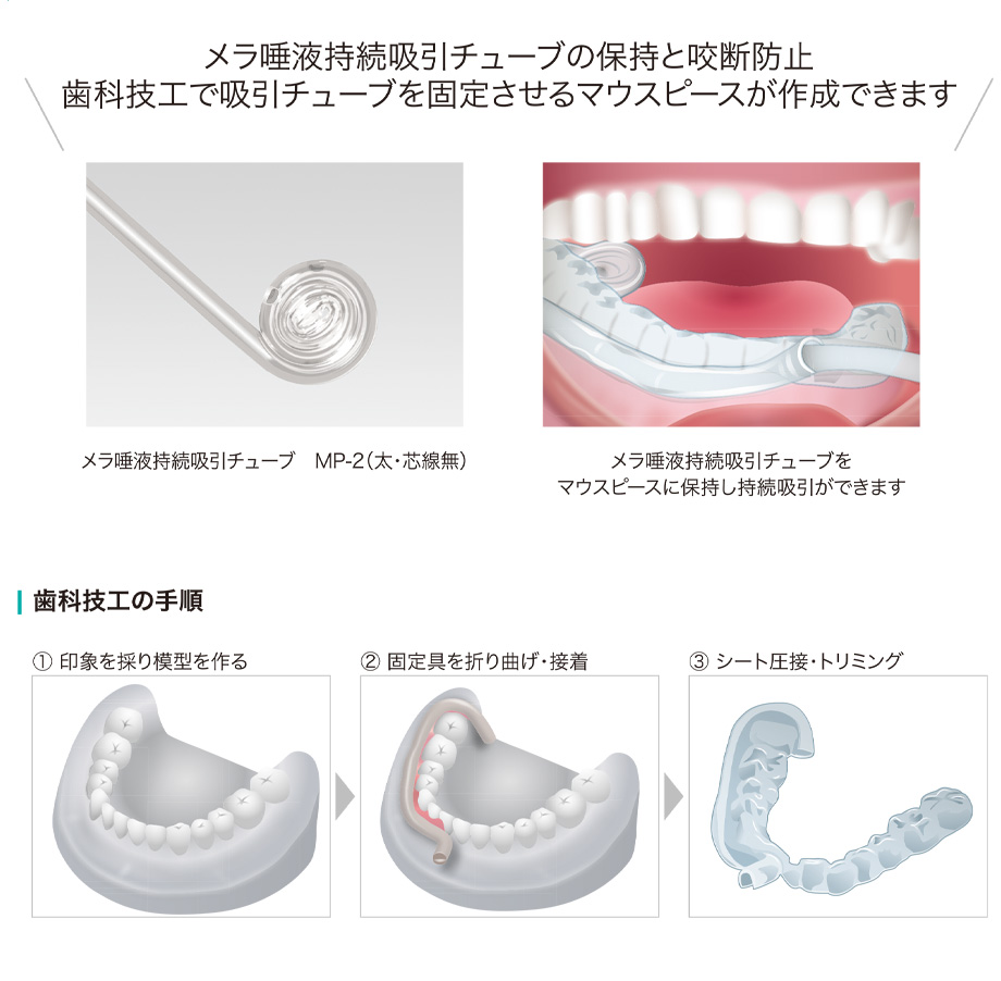 メラ唾液持続吸引チューブの保持と咬断防止/歯科技工で吸引チューブを固定させるマウスピースが作成できます。