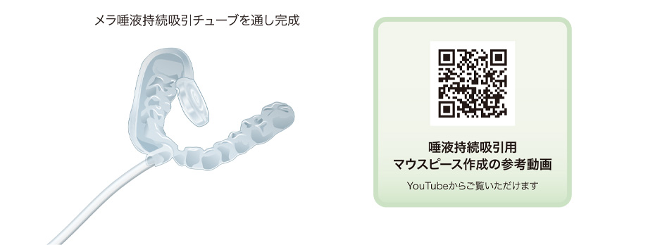 唾液持続吸引用マウスピース作成の参考動画