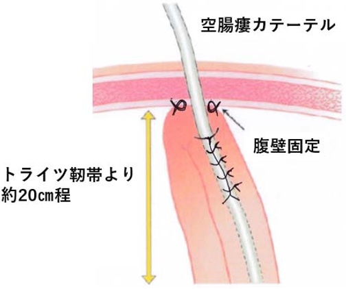 図１