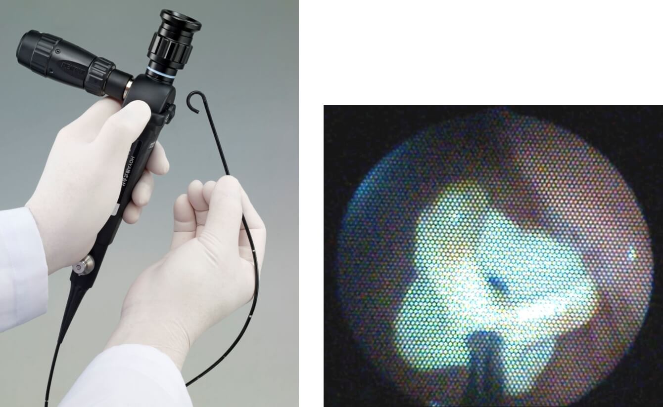 図7　経胃瘻カテーテル内視鏡 PEGスコープ